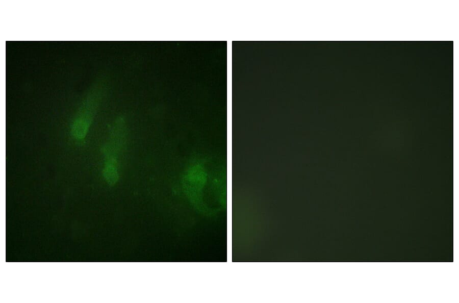 Immunofluorescence - Anti-FANCA (phospho Ser1149) Antibody (A1148) - Antibodies.com