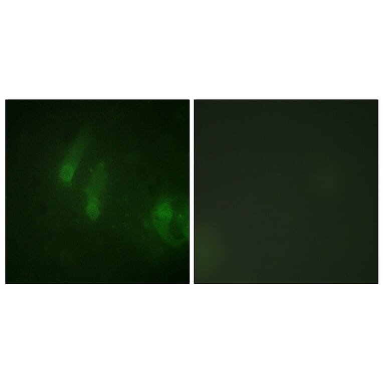 Immunofluorescence - Anti-FANCA (phospho Ser1149) Antibody (A1148) - Antibodies.com