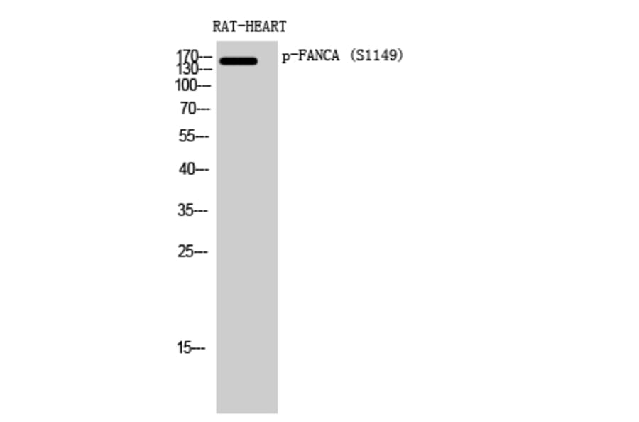 Western Blot - Anti-FANCA (phospho Ser1149) Antibody (A1148) - Antibodies.com