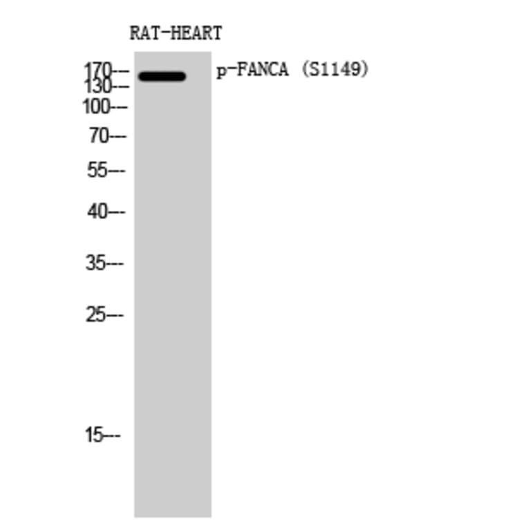 Western Blot - Anti-FANCA (phospho Ser1149) Antibody (A1148) - Antibodies.com