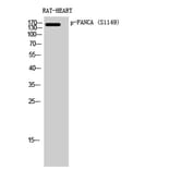 Western Blot - Anti-FANCA (phospho Ser1149) Antibody (A1148) - Antibodies.com