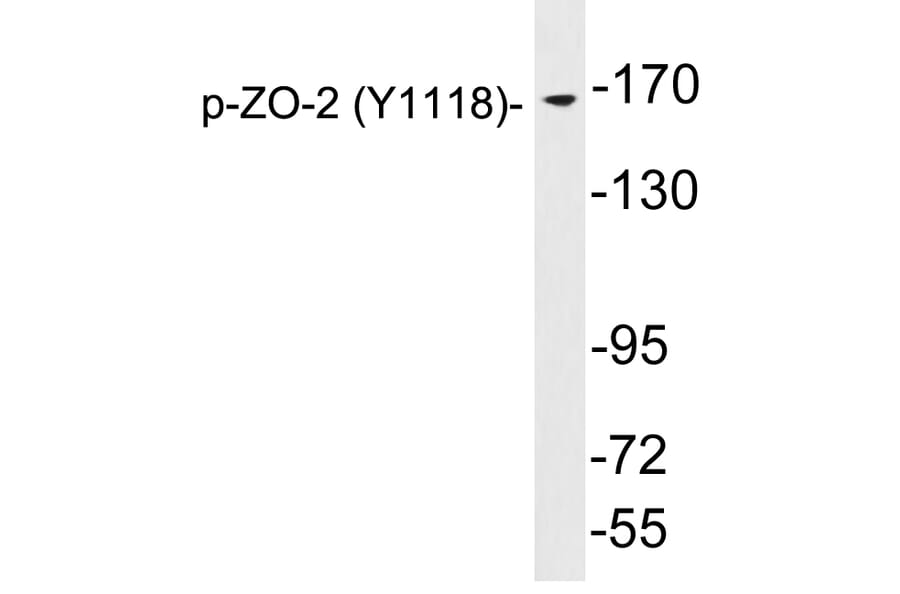 Western Blot - Anti-ZO-2 (phospho Tyr1118) Antibody (P12-1069) - Antibodies.com