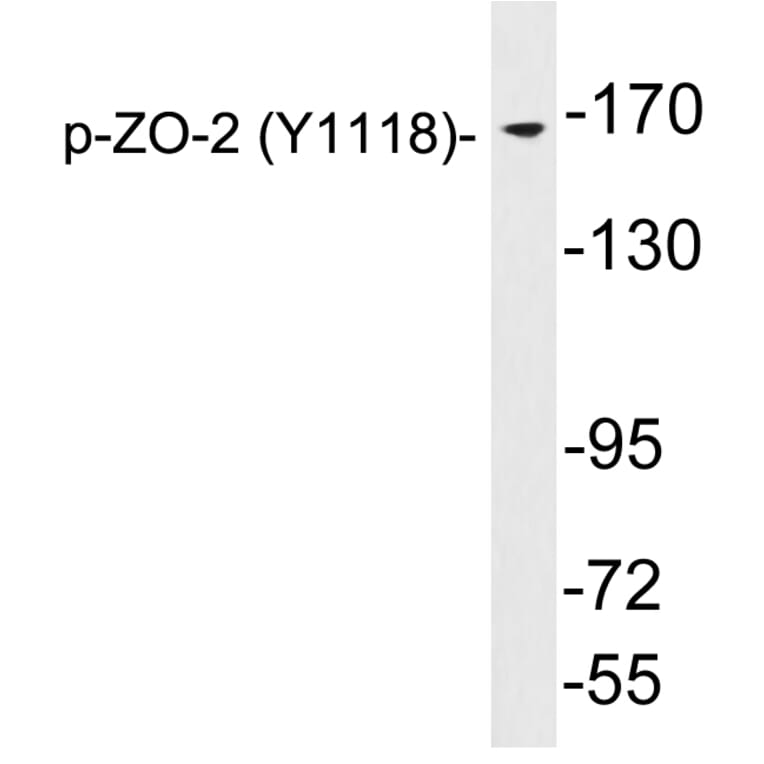 Western Blot - Anti-ZO-2 (phospho Tyr1118) Antibody (P12-1069) - Antibodies.com