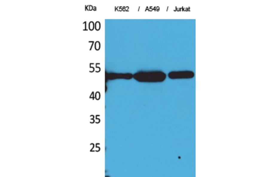 Western Blot - Anti-TUBA1B (acetyl Lys352) Antibody (D12203) - Antibodies.com
