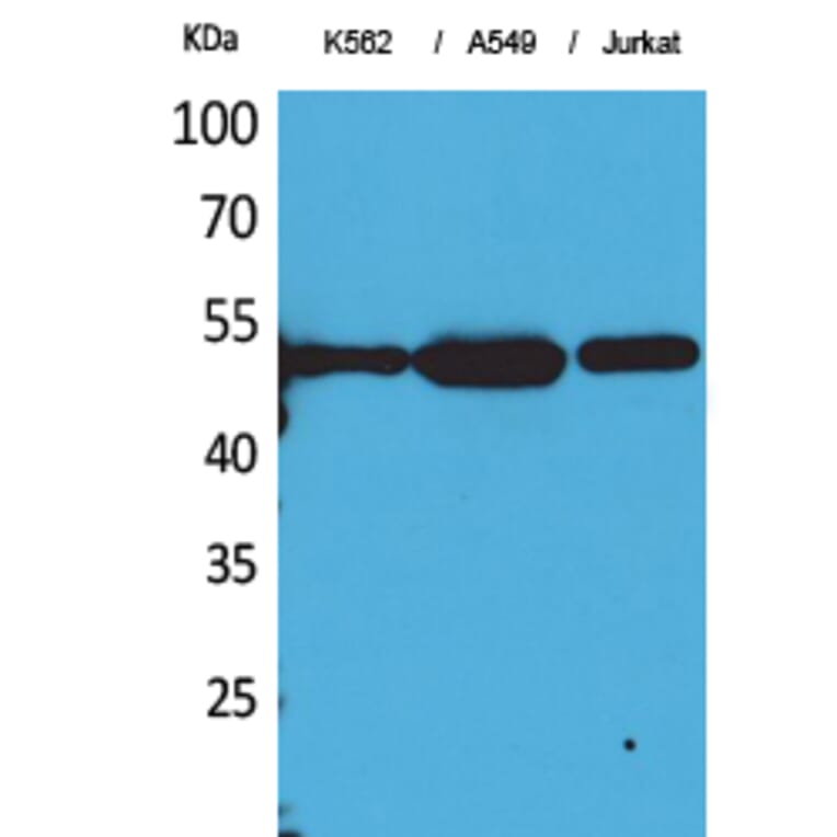 Western Blot - Anti-TUBA1B (acetyl Lys352) Antibody (D12203) - Antibodies.com