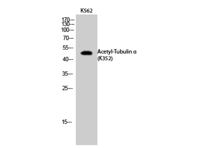 Western Blot - Anti-TUBA1B (acetyl Lys352) Antibody (D12203) - Antibodies.com