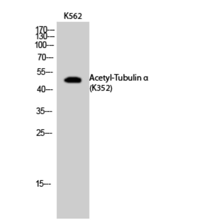 Western Blot - Anti-TUBA1B (acetyl Lys352) Antibody (D12203) - Antibodies.com