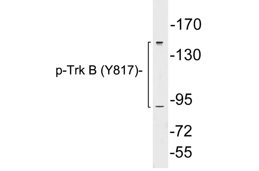 Western Blot - Anti-Trk B (phospho Tyr817) Antibody (P12-1062) - Antibodies.com