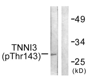 Western Blot - Anti-TNNI3 (phospho Thr142) Antibody (A0588) - Antibodies.com