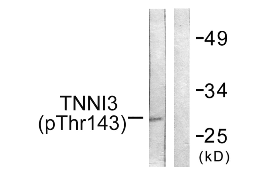 Western Blot - Anti-TNNI3 (phospho Thr142) Antibody (A0588) - Antibodies.com