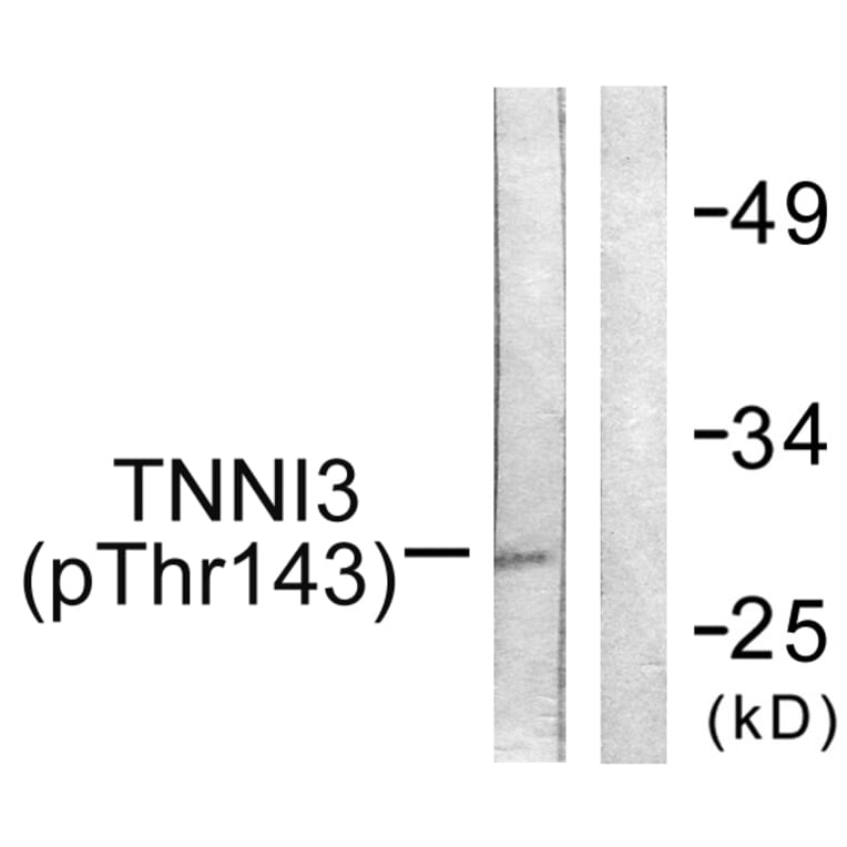 Western Blot - Anti-TNNI3 (phospho Thr142) Antibody (A0588) - Antibodies.com