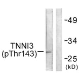 Western Blot - Anti-TNNI3 (phospho Thr142) Antibody (A0588) - Antibodies.com