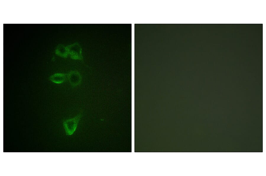 Immunofluorescence - Anti-TIE2 (phospho Tyr1108) Antibody (A0585) - Antibodies.com
