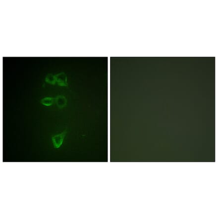 Immunofluorescence - Anti-TIE2 (phospho Tyr1108) Antibody (A0585) - Antibodies.com