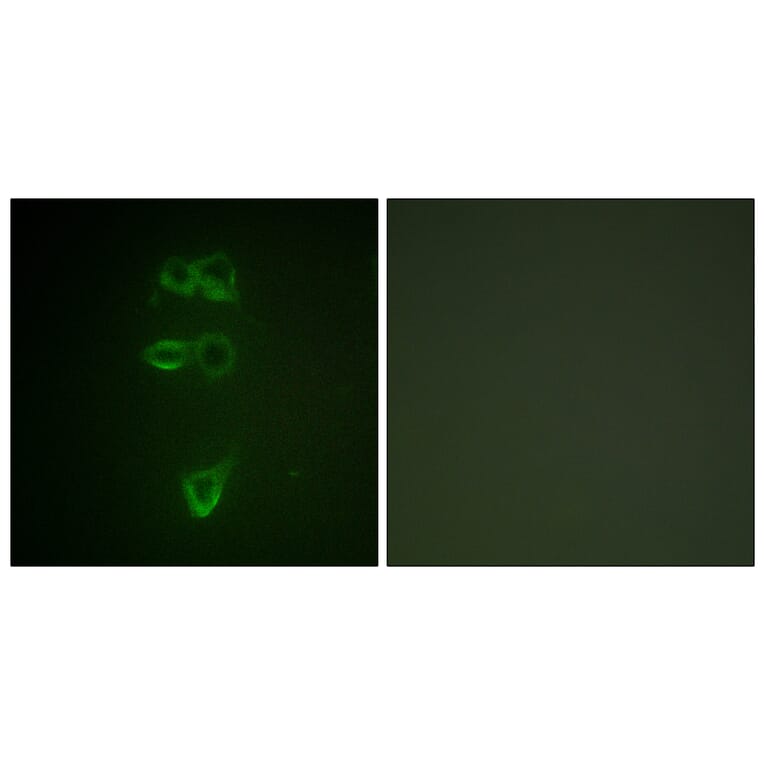 Immunofluorescence - Anti-TIE2 (phospho Tyr1108) Antibody (A0585) - Antibodies.com