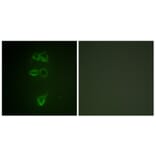 Immunofluorescence - Anti-TIE2 (phospho Tyr1108) Antibody (A0585) - Antibodies.com