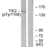 Western Blot - Anti-TIE2 (phospho Tyr1108) Antibody (A0585) - Antibodies.com