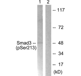Western Blot - Anti-Smad3 (phospho Ser213) Antibody (A1007) - Antibodies.com