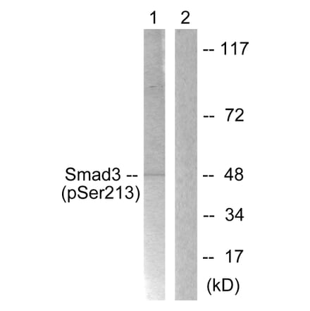Western Blot - Anti-Smad3 (phospho Ser213) Antibody (A1007) - Antibodies.com