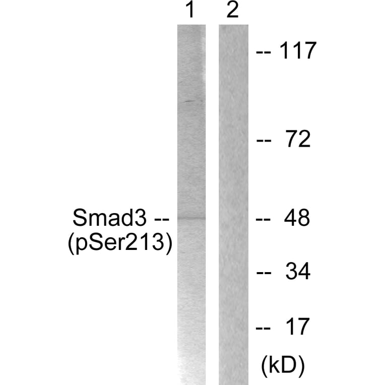 Western Blot - Anti-Smad3 (phospho Ser213) Antibody (A1007) - Antibodies.com