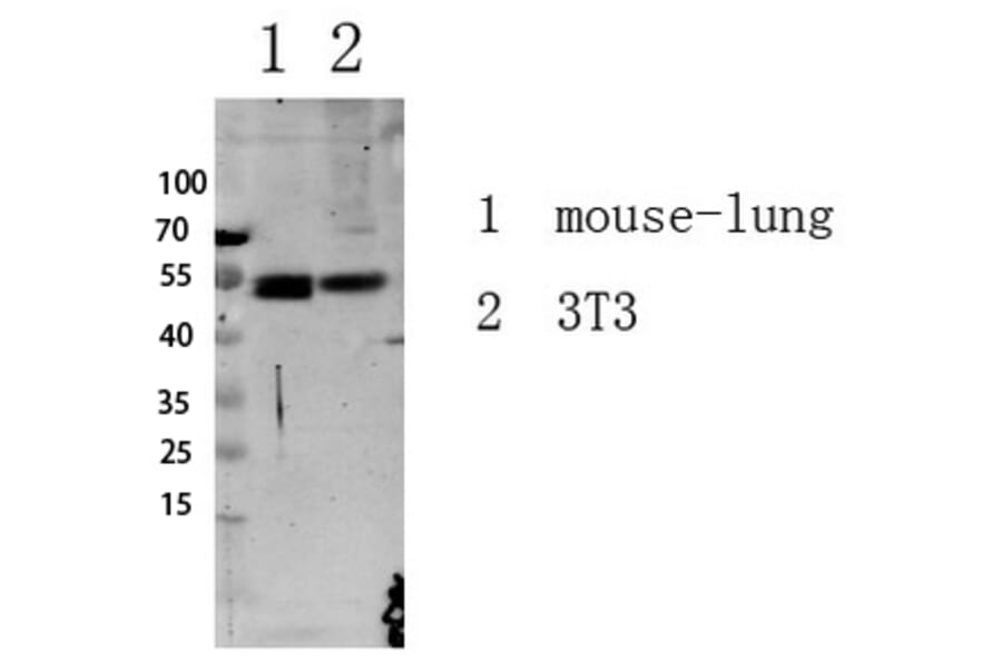 Western Blot - Anti-Smad3 (phospho Ser213) Antibody (A1007) - Antibodies.com