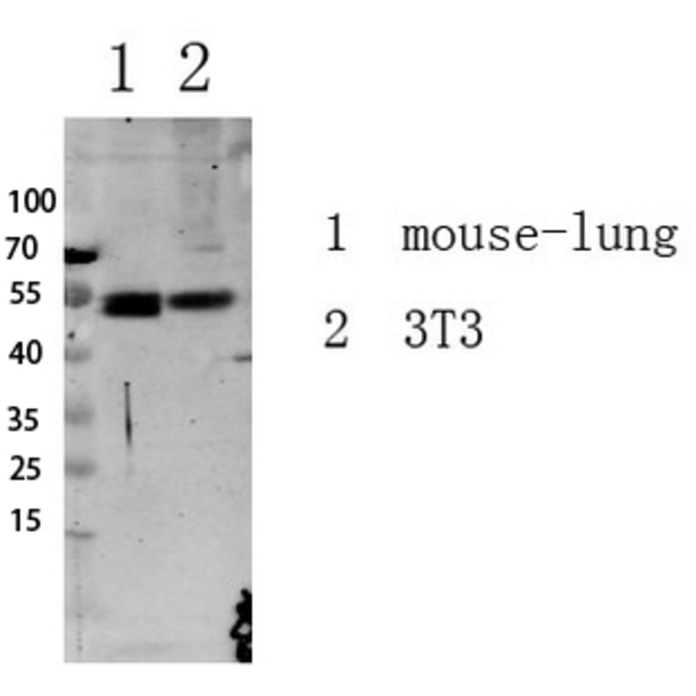 Western Blot - Anti-Smad3 (phospho Ser213) Antibody (A1007) - Antibodies.com