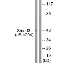 Western Blot - Anti-Smad3 (phospho Ser204) Antibody (A1004) - Antibodies.com