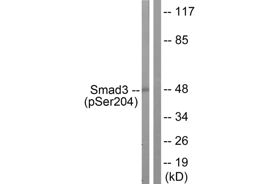 Western Blot - Anti-Smad3 (phospho Ser204) Antibody (A1004) - Antibodies.com