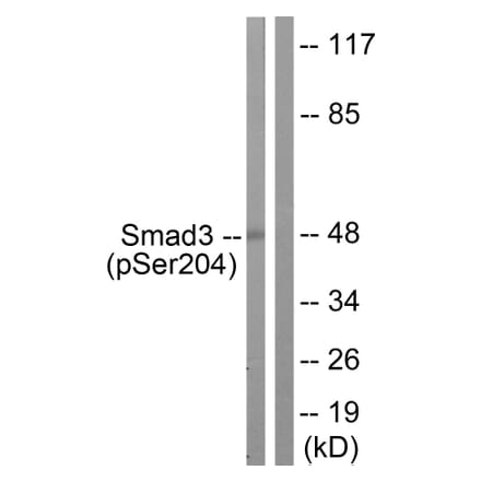 Western Blot - Anti-Smad3 (phospho Ser204) Antibody (A1004) - Antibodies.com