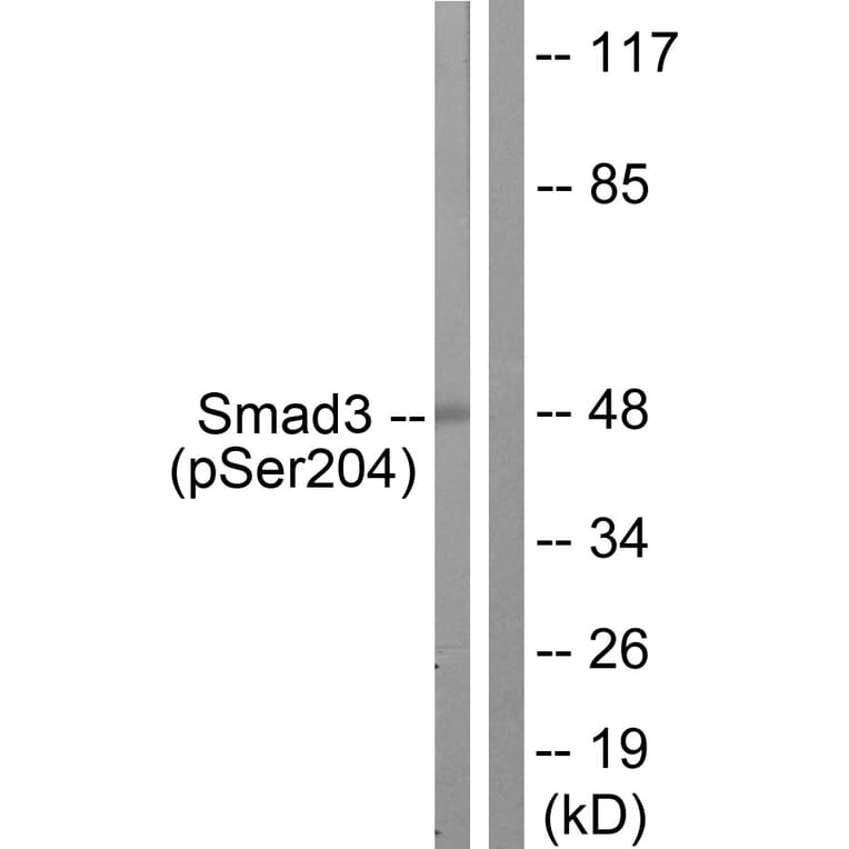 Western Blot - Anti-Smad3 (phospho Ser204) Antibody (A1004) - Antibodies.com