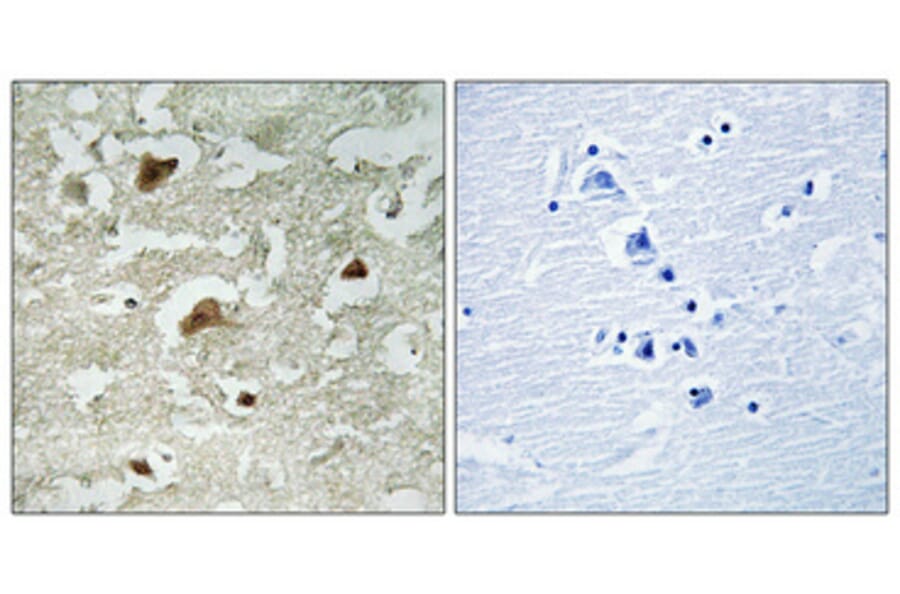 Immunohistochemistry - Anti-Smad3 (phospho Ser204) Antibody (A1004) - Antibodies.com