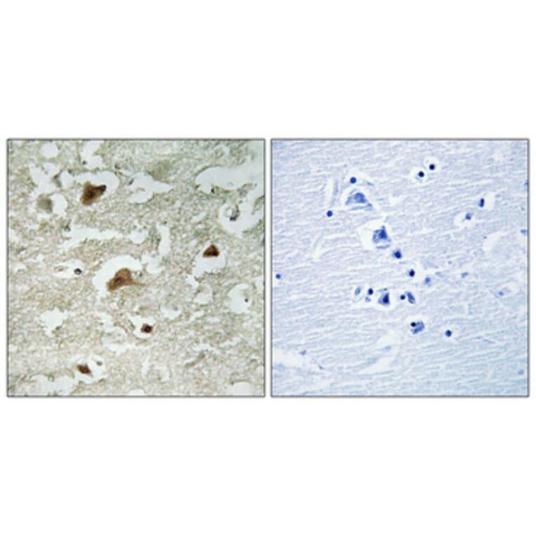 Immunohistochemistry - Anti-Smad3 (phospho Ser204) Antibody (A1004) - Antibodies.com