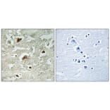 Immunohistochemistry - Anti-Smad3 (phospho Ser204) Antibody (A1004) - Antibodies.com