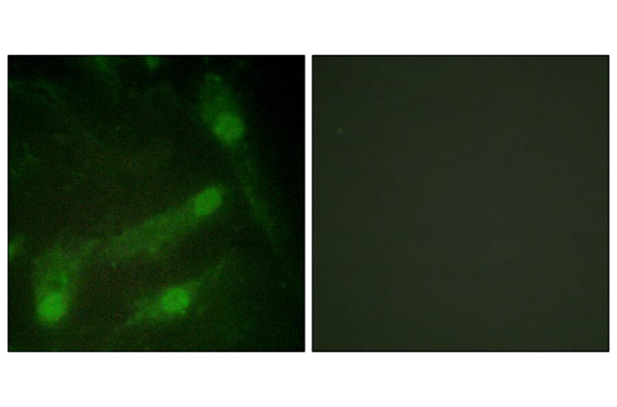 Immunofluorescence - Anti-Smad2 (phospho Thr220) Antibody (A1000) - Antibodies.com