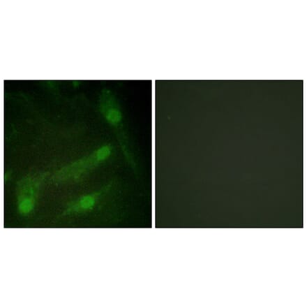 Immunofluorescence - Anti-Smad2 (phospho Thr220) Antibody (A1000) - Antibodies.com