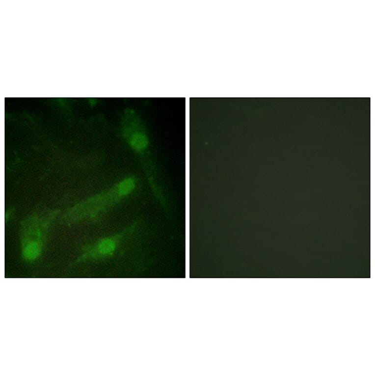 Immunofluorescence - Anti-Smad2 (phospho Thr220) Antibody (A1000) - Antibodies.com