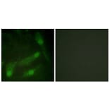 Immunofluorescence - Anti-Smad2 (phospho Thr220) Antibody (A1000) - Antibodies.com