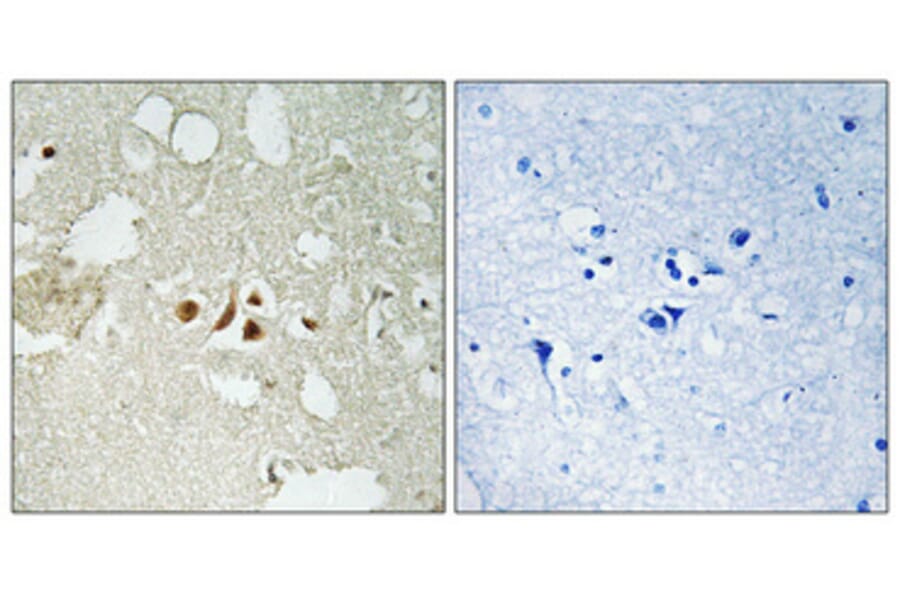 Immunohistochemistry - Anti-Smad2 (phospho Thr220) Antibody (A1000) - Antibodies.com
