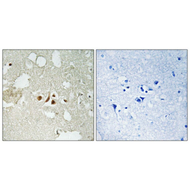 Immunohistochemistry - Anti-Smad2 (phospho Thr220) Antibody (A1000) - Antibodies.com