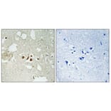 Immunohistochemistry - Anti-Smad2 (phospho Thr220) Antibody (A1000) - Antibodies.com