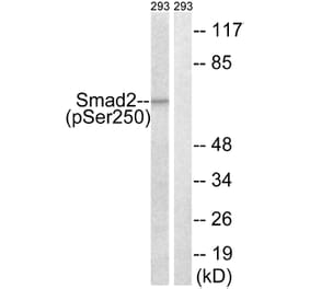 Western Blot - Anti-Smad2 (phospho Ser250) Antibody (A0998) - Antibodies.com