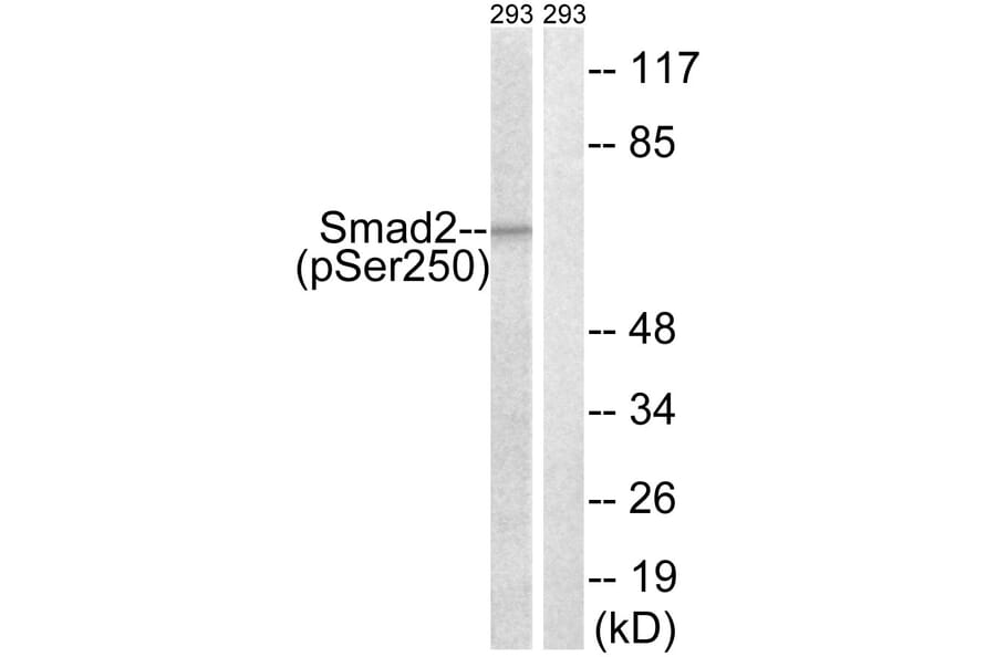 Western Blot - Anti-Smad2 (phospho Ser250) Antibody (A0998) - Antibodies.com
