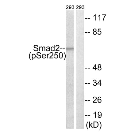 Western Blot - Anti-Smad2 (phospho Ser250) Antibody (A0998) - Antibodies.com