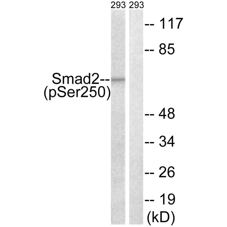 Western Blot - Anti-Smad2 (phospho Ser250) Antibody (A0998) - Antibodies.com