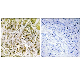 Immunohistochemistry - Anti-Smad1 (phospho Ser187) Antibody (A0994) - Antibodies.com