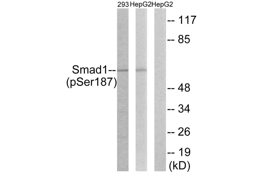 Western Blot - Anti-Smad1 (phospho Ser187) Antibody (A0994) - Antibodies.com