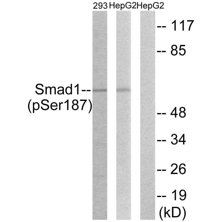 Western Blot - Anti-Smad1 (phospho Ser187) Antibody (A0994) - Antibodies.com