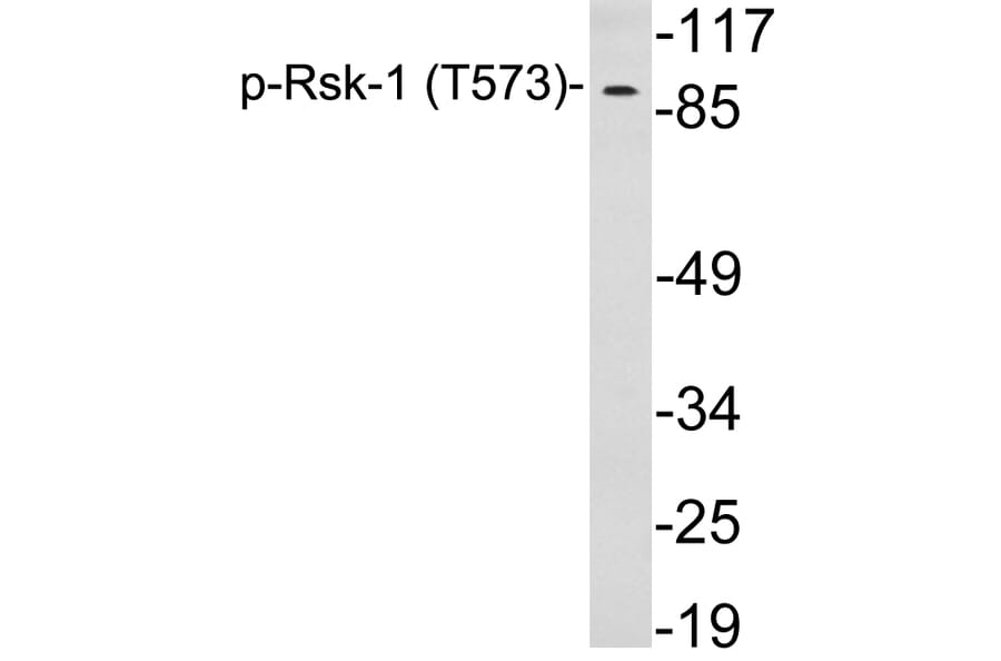 Western Blot - Anti-Rsk-1 (phospho Thr573) Antibody (P12-1053) - Antibodies.com