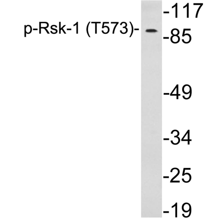 Western Blot - Anti-Rsk-1 (phospho Thr573) Antibody (P12-1053) - Antibodies.com