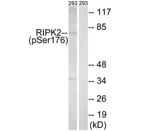 Western Blot - Anti-RIPK2 (phospho Ser176) Antibody (A8180) - Antibodies.com